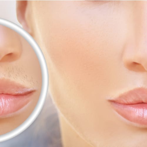 Vrouw met haar op haar lip