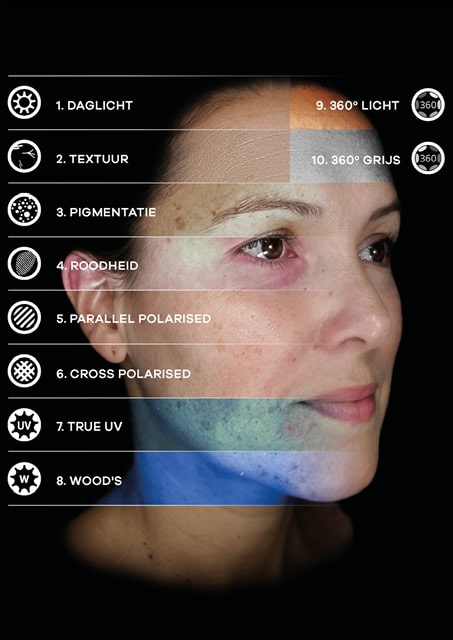 OBSERV 520X huidanalyse Forever Jong Nijmegen